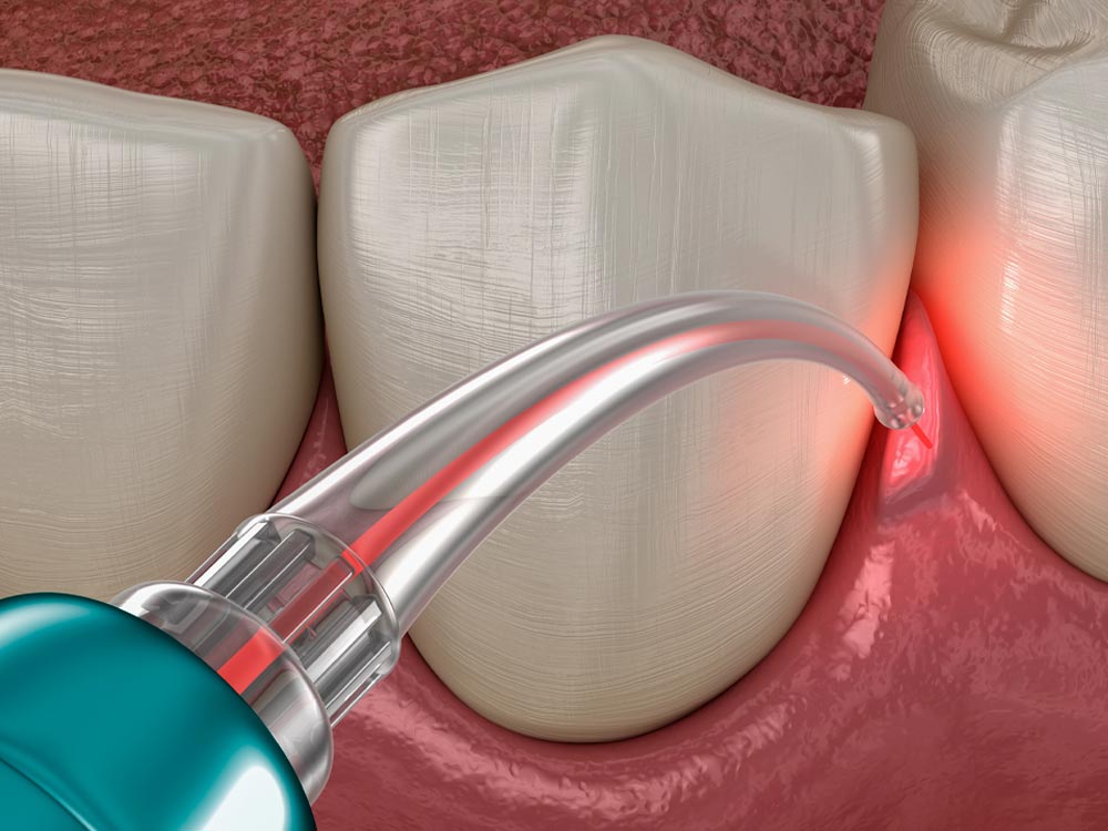 V Dentist Dental Care