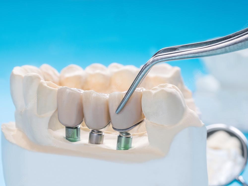 V Dentist Dental Care